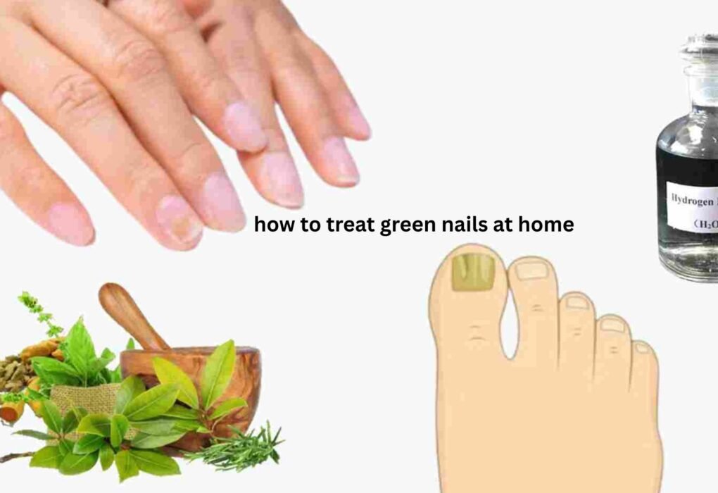 How to Treat Green Nails at Home Safely