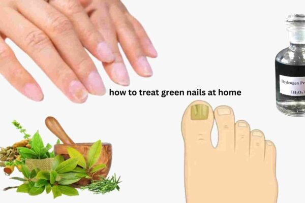 How to Treat Green Nails at Home Safely