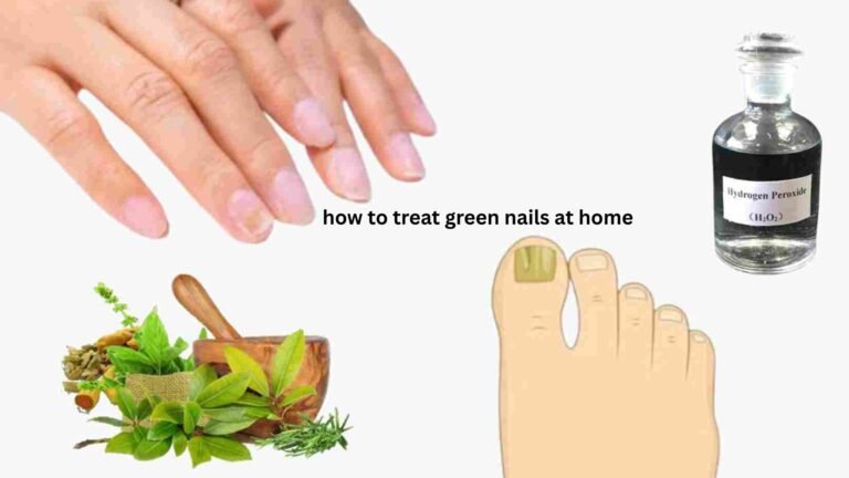 How to Treat Green Nails at Home Safely