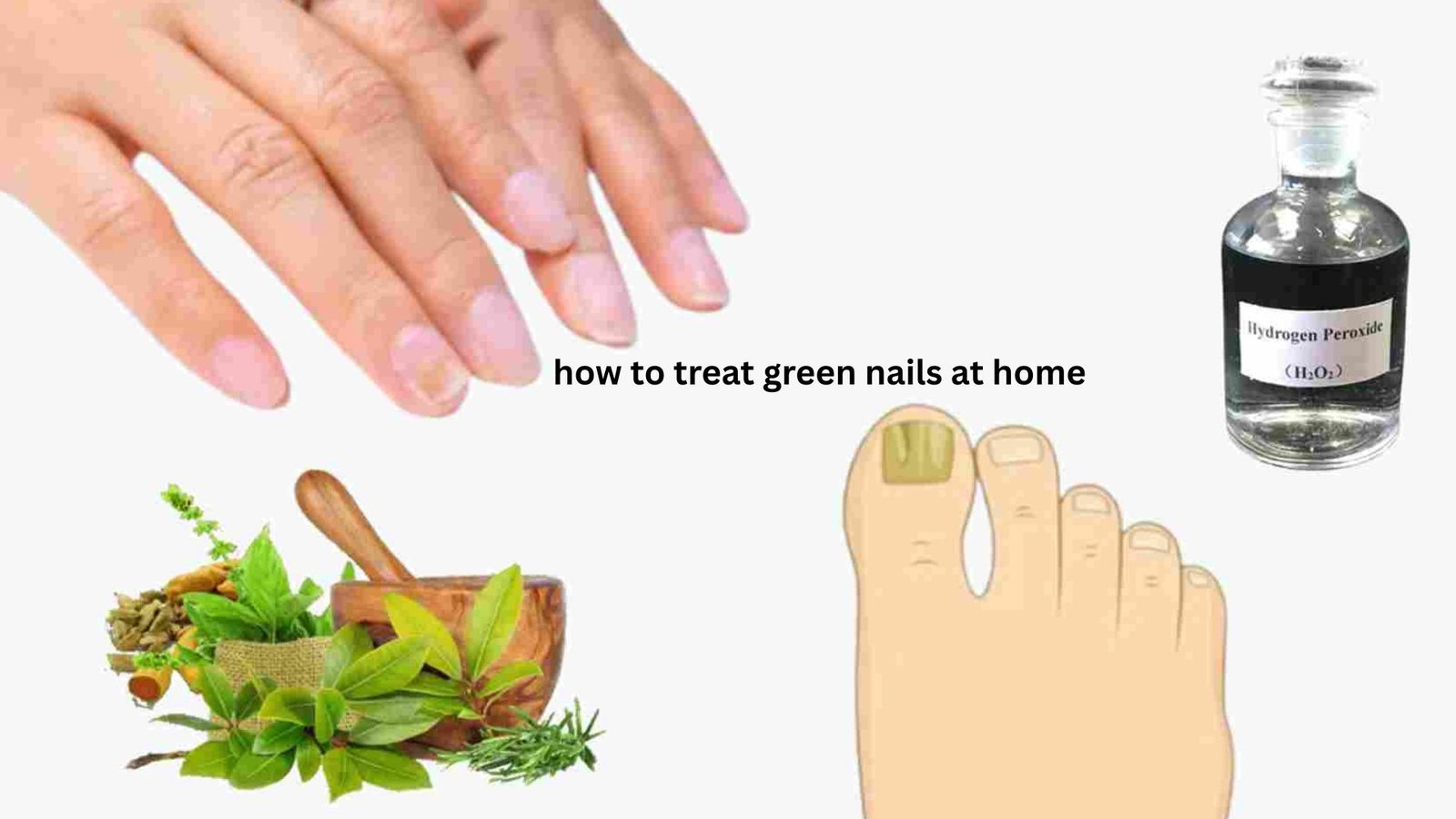 How to Treat Green Nails at Home Safely