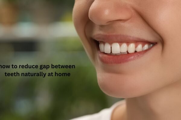 How to Reduce Gap Between Teeth Naturally at Home