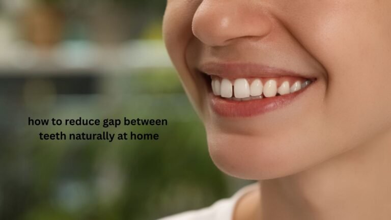 How to Reduce Gap Between Teeth Naturally at Home